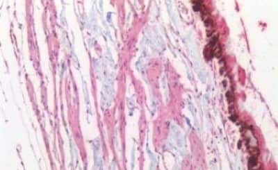 Immunohistochemistry-Paraffin: BRN3A Antibody [NBP3-14551] - Human Retina: Formalin-Fixed, Paraffin-Embedded (FFPE)